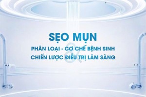 Sẹo Mụn: Phân loại, Cơ chế bệnh sinh và chiến lược điều trị lâm sàng
