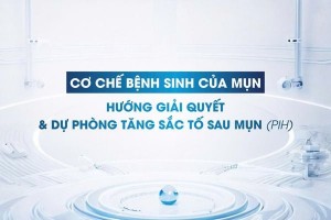Cơ chế bệnh sinh của mụn, hướng giải quyết và dự phòng tăng sắc tố sau mụn (PIH)