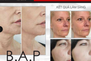 Review sản phẩm BAP cải thiện lão hóa và tái tạo da trắng sáng Infini DNA+ Superbooster