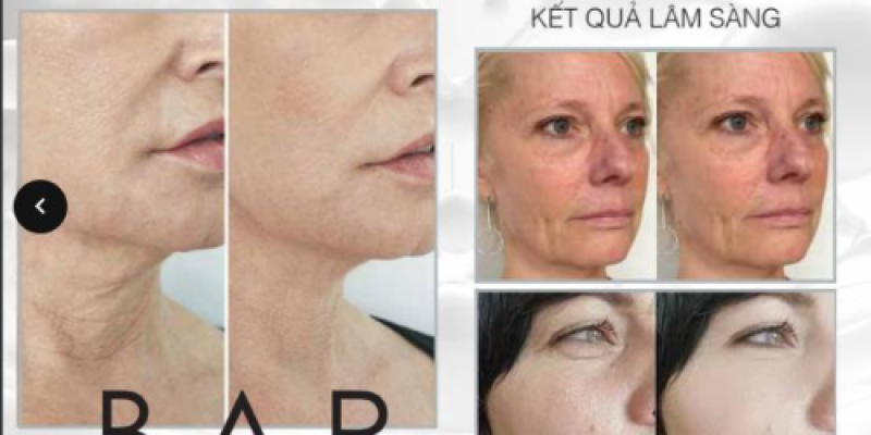 Review sản phẩm BAP cải thiện lão hóa và tái tạo da trắng sáng Infini DNA+ Superbooster